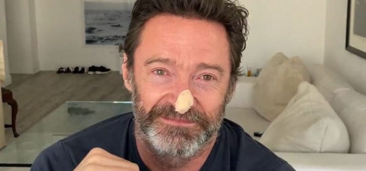 Hugh Jackman se sometió a otra biopsia y alerta sobre el cáncer de piel