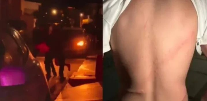 Policías agreden a jóvenes con cinturones en Sonora